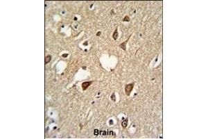 Immunohistochemistry (Paraffin-embedded Sections) (IHC (p)) image for anti-Small Ubiquitin Related Modifier Protein 1 (SUMO1) antibody (ABIN650618)