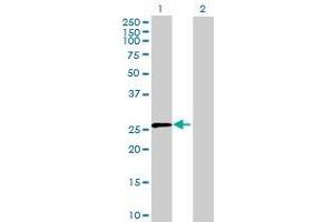Lane 1: GZMK transfected lysate ( 28. (GZMK 293T Cell Transient Overexpression Lysate(Denatured))