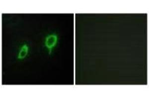 Immunofluorescence analysis of COS7 cells, using 14-3-3 γ antibody. (14-3-3 gamma antibody)