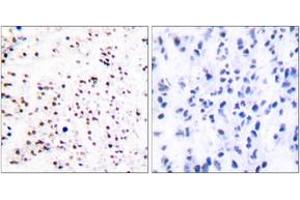 Immunohistochemistry analysis of paraffin-embedded human tonsil tissue, using MCM5 Antibody. (MCM5 antibody  (AA 21-70))