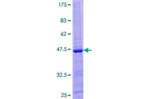 IL-26 Protein (AA 1-171) (GST tag)