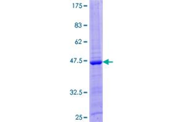 IL-26 Protein (AA 1-171) (GST tag)