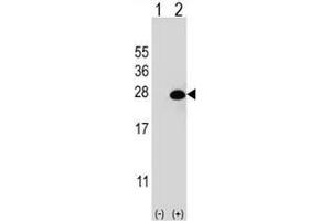 Western blot analysis of DGCR6L (arrow) using rabbit polyclonal DGCR6L Antibody (Center) . (DGCR6L antibody  (Middle Region))