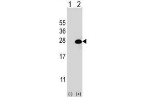 Western Blotting (WB) image for anti-DiGeorge Syndrome Critical Region Gene 6-Like (DGCR6L) (AA 107-135), (Middle Region) antibody (ABIN951902)