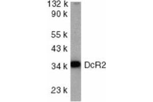 Western blot analysis of DcR2 in HeLa whole cell lysate with AP30280PU-N DcR2 antibody at 1/1000 dilution. (DcR2 antibody  (Intracellular))