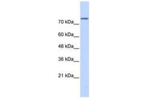 Image no. 1 for anti-Phospholipase D2 (PLD2) (AA 467-516) antibody (ABIN6740325) (Phospholipase D2 antibody  (AA 467-516))