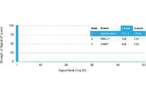 Analysis of Protein Array containing more than 19,000 full-length human proteins using Spectrin beta III Mouse Monoclonal Antibody (SPTBN2/1778). (Spectrin, Beta, Non-erythrocytic 2 (SPTBN2) (AA 356-475) antibody)