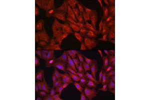 Immunofluorescence analysis of U-2 OS cells using VASP Rabbit pAb (ABIN6134453, ABIN6150064, ABIN6150065 and ABIN6218508) at dilution of 1:100 (40x lens). (VASP antibody  (AA 1-100))