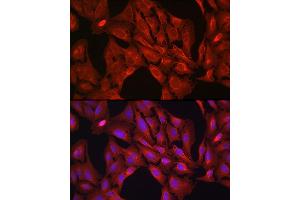 Immunofluorescence analysis of U-2 OS cells using VASP Rabbit pAb (ABIN6134453, ABIN6150064, ABIN6150065 and ABIN6218508) at dilution of 1:100 (40x lens). (VASP antibody  (AA 1-100))