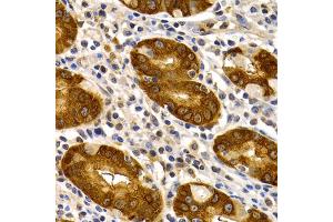 Immunohistochemistry of paraffin-embedded human stomach using TFF1 antibody. (TFF1 antibody)