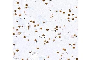 Immunohistochemistry (Paraffin-embedded Sections) (IHC (p)) image for anti-Topoisomerase (DNA) II alpha 170kDa (TOP2A) antibody (ABIN7075937)