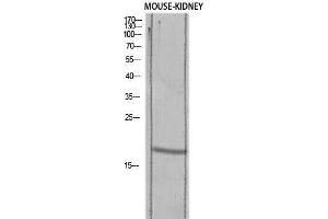 Western Blot (WB) analysis of Mouse Kidney lysis using TGFA antibody.