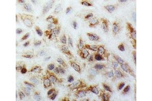 ICC testing of SMAD1 antibody and A549 cells (SMAD1 antibody  (C-Term))