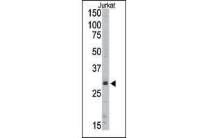 Image no. 1 for anti-Sirtuin 5 (SIRT5) (C-Term) antibody (ABIN358734) (SIRT5 antibody  (C-Term))