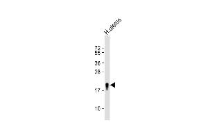 Anti-TAGLN Antibody (N-term) at 1:8000 dilution + H. (Transgelin antibody  (N-Term))