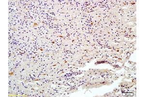 Formalin-fixed and paraffin embedded human brain labeled with Anti-HDAC6 Polyclonal Antibody, Unconjugated (ABIN681058) at 1:200 followed by conjugation to the secondary antibody and DAB staining (HDAC6 antibody  (AA 301-400))