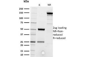 SDS-PAGE Analysis of Purified CD5 Mouse Monoclonal Antibody ABIN6383881. (CD5 antibody  (Extracellular Domain))