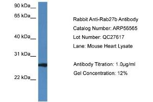 Western Blotting (WB) image for anti-RAB27B, Member RAS Oncogene Family (RAB27B) (C-Term) antibody (ABIN2786775) (RAB27B antibody  (C-Term))