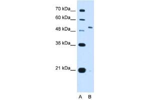 Western Blotting (WB) image for anti-Potassium Voltage-Gated Channel, Shaw-Related Subfamily, Member 1 (KCNC1) (N-Term) antibody (ABIN630383)