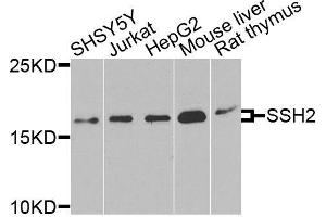 Western blot analysis of extracts of various cell lines, using SSH2 antibody (ABIN6003697) at 1/1000 dilution. (SSH2 antibody)
