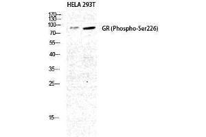 Western Blotting (WB) image for anti-GR (pSer226) antibody (ABIN3182520) (GR (pSer226) antibody)
