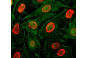 ICC/IF testing of HeLa cells treated with sodium butyrate using recombinant H3K9ac antibody (red). (Recombinant Histone 3 antibody  (acLys9))