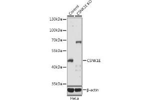 Western blot analysis of extracts from normal (control) and CSNK1E knockout (KO) HeLa cells, using CSNK1E antibody (ABIN6128970, ABIN6139116, ABIN6139117 and ABIN7101448) at 1:1000 dilution.