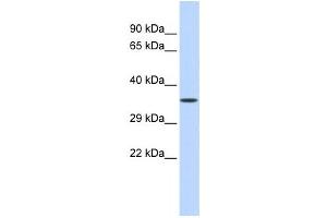 Western Blotting (WB) image for anti-Zinc Finger Protein 124 (ZNF124) antibody (ABIN2458312) (ZNF124 antibody)