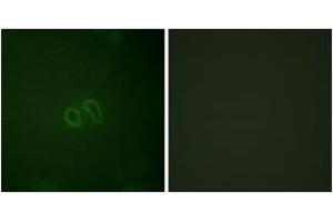 Immunofluorescence analysis of HepG2 cells, using Vinculin (Phospho-Tyr821) Antibody. (Vinculin antibody  (pTyr821))