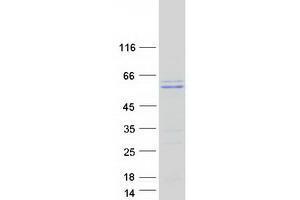 Validation with Western Blot (Thymopoietin Protein (TMPO) (Transcript Variant 2) (Myc-DYKDDDDK Tag))