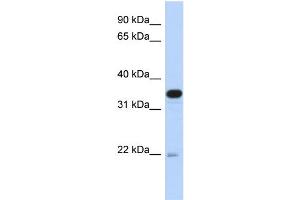 WB Suggested Anti-PITPNB Antibody Titration: 0. (PITPNB antibody  (Middle Region))