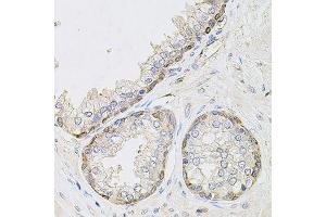Immunohistochemistry of paraffin-embedded human prostate using CIB1 antibody. (CIB1 antibody  (AA 1-191))