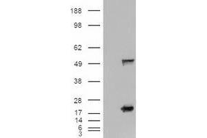 Image no. 3 for anti-Sonic Hedgehog (SHH) (AA 24-197) antibody (ABIN1491248) (Sonic Hedgehog antibody  (AA 24-197))