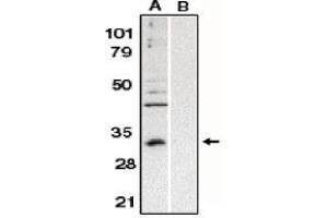 Image no. 1 for anti-B-Cell CLL/lymphoma 10 (BCL10) (AA 5-19) antibody (ABIN264992) (BCL10 antibody  (AA 5-19))