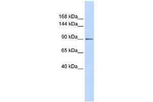 WB Suggested Anti-PHF16 Antibody Titration:  0.