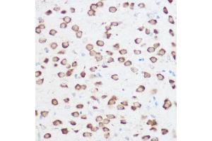 Immunohistochemistry of paraffin-embedded rat brain using RPS24 Rabbit pAb (ABIN6133032, ABIN6147213, ABIN6147214 and ABIN6215701) at dilution of 1:200 (40x lens). (RPS24 antibody  (AA 1-130))