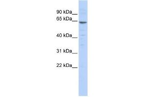WB Suggested Anti-ZNF192 Antibody Titration:  0. (ZNF192 antibody  (N-Term))