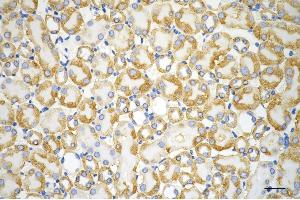 Immunohistochemistry was performed on paraffin-embedded mouse kidney using ACAT1 antibody (ABIN7797438), 1:200). (ACAT1 antibody)
