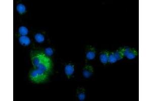 Image no. 5 for anti-Sequestosome 1 (SQSTM1) antibody (ABIN1499991) (SQSTM1 antibody)