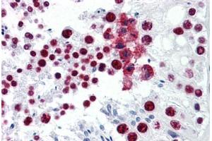 Human Testis: Formalin-Fixed, Paraffin-Embedded (FFPE) (CDKL1 antibody  (AA 259-358))