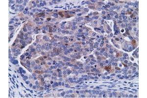 Immunohistochemical staining of paraffin-embedded Human Kidney tissue using anti-CD80 mouse monoclonal antibody. (CD80 antibody)