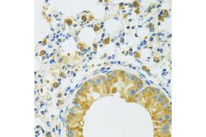Immunohistochemistry of paraffin-embedded mouse lung using SLC37A4 antibody.
