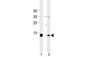 Myoglobin antibody western blot analysis in mouse 1) heart and 2) skeletal muscle tissue lysate. (Myoglobin antibody  (AA 103-130))
