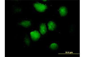 Immunofluorescence of purified MaxPab antibody to ZNF74 on HeLa cell. (ZNF74 antibody  (AA 1-644))