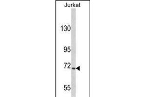 Western blot analysis of hUSP19- (ABIN388908 and ABIN2839191) in Jurkat cell line lysates (35 μg/lane). (USP19 antibody  (C-Term))