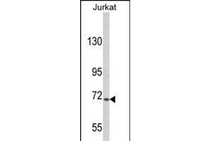 Western blot analysis of hUSP19- (ABIN388908 and ABIN2839191) in Jurkat cell line lysates (35 μg/lane). (USP19 antibody  (C-Term))