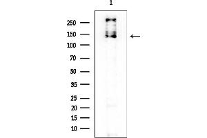 Western blot analysis of lysates from EC304 cells, using DZIP3 Mouse Monoclonal Antibody at 1/1000 dilution.