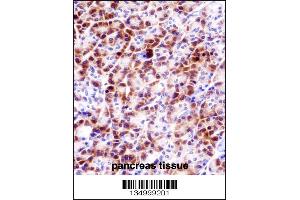 PRSS27 Antibody immunohistochemistry analysis in formalin fixed and paraffin embedded human pancreas tissue followed by peroxidase conjugation of the secondary antibody and DAB staining. (PRSS27 antibody  (C-Term))