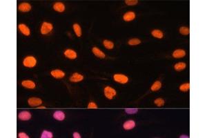 Immunofluorescence analysis of U-2 OS cells using ZBED1 Polyclonal Antibody at dilution of 1:100. (ZBED1 antibody)