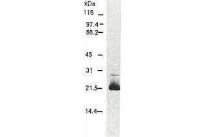 Western Blotting (WB) image for anti-Hepatitis C Virus Core Protein (HCV C) (AA 13-124), (AA 369-704) antibody (Biotin) (ABIN2451996)